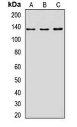 Western blot analysis of A431 (Lane1), MCF7 (Lane2), rat kidney (Lane3) whole cell lysates using NOMO1 antibody