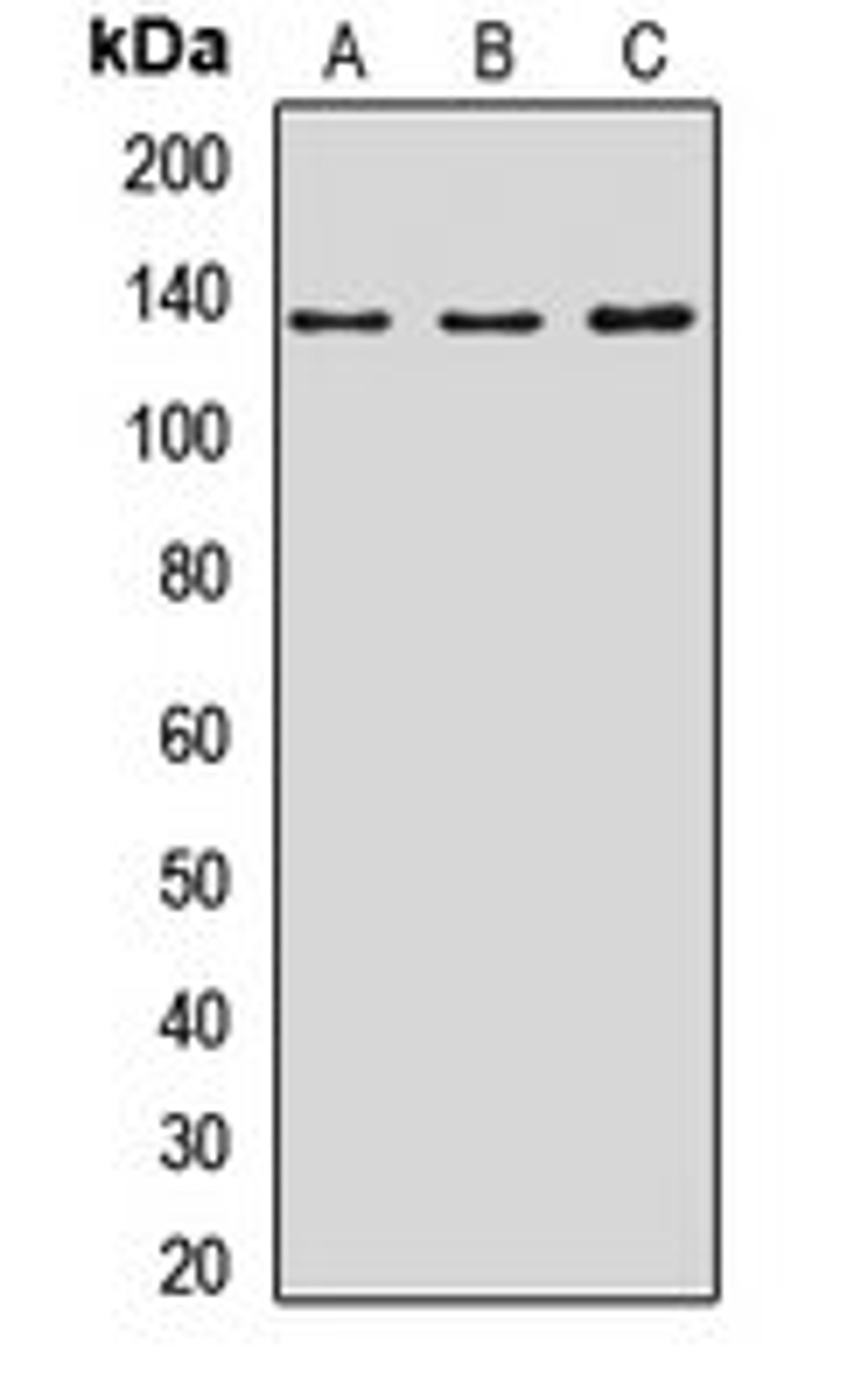 Western blot analysis of A431 (Lane1), MCF7 (Lane2), rat kidney (Lane3) whole cell lysates using NOMO1 antibody