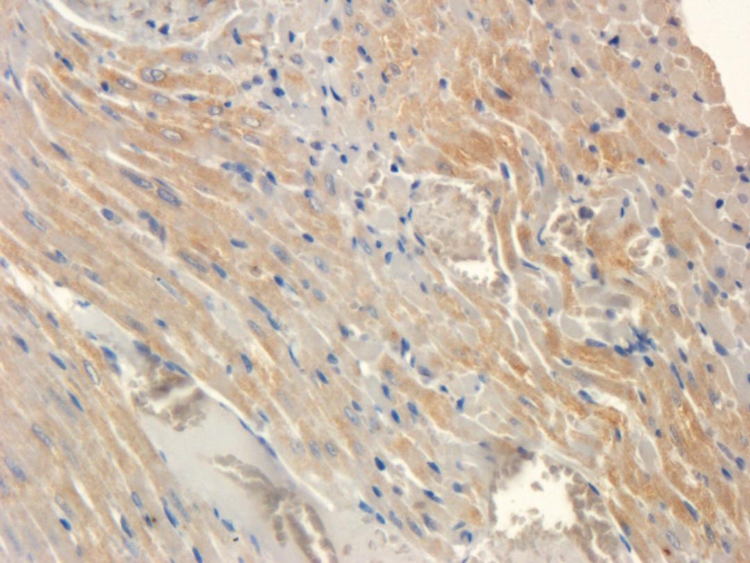 Immunohistochemical staining of rat heart tissue using SOD2 antibody (2.5 ug/ml)