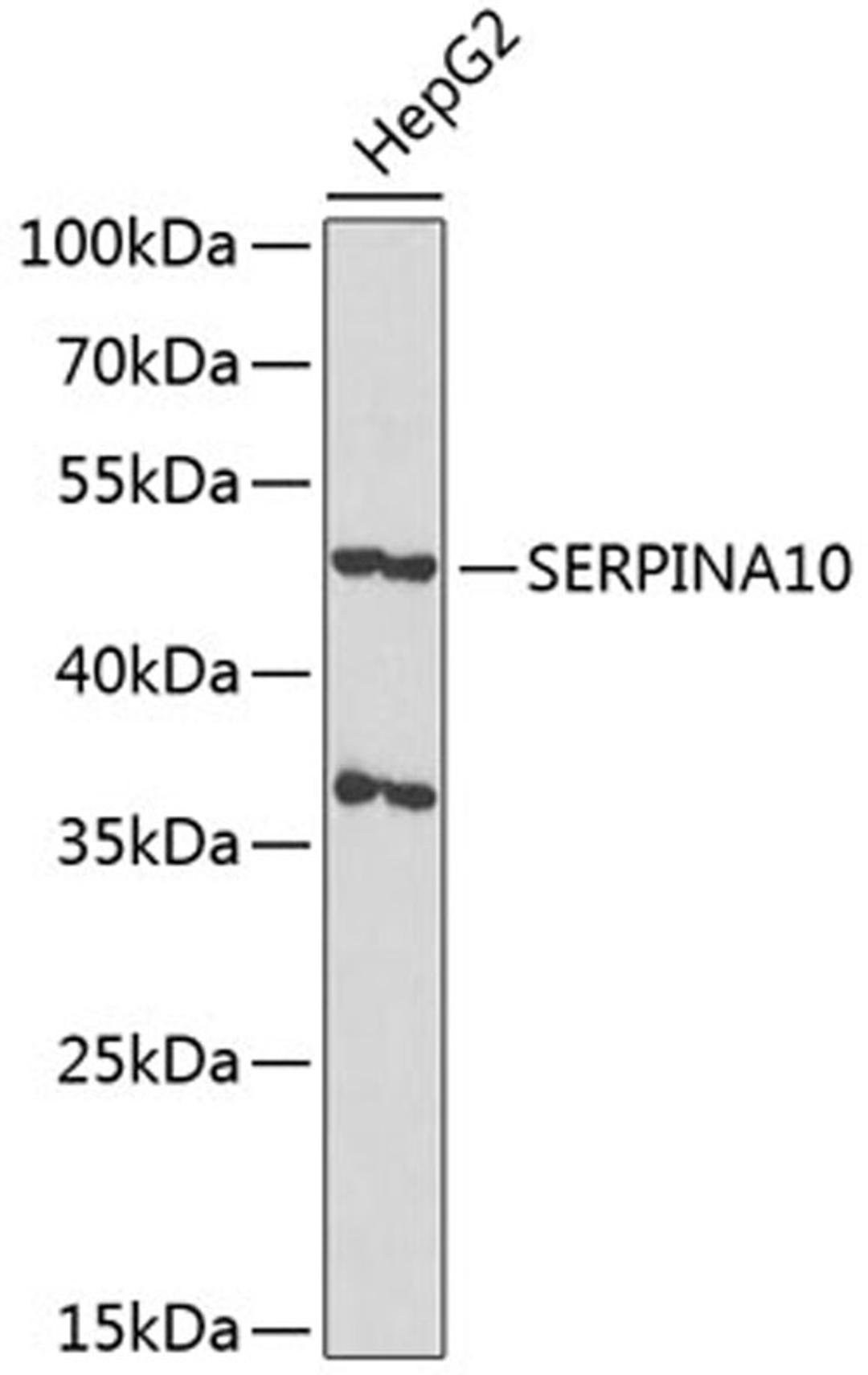 Western blot - SERPINA10 antibody (A4717)