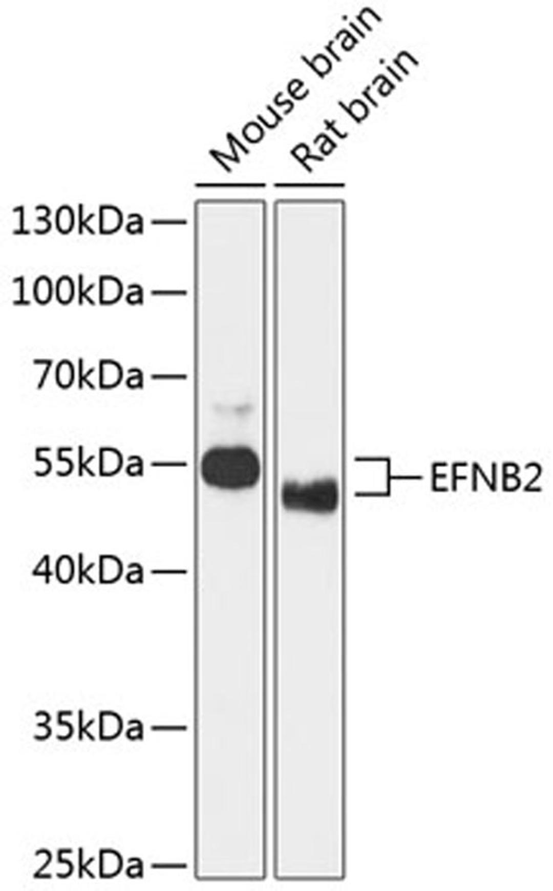 Western blot - EFNB2 antibody (A12961)