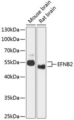 Western blot - EFNB2 antibody (A12961)