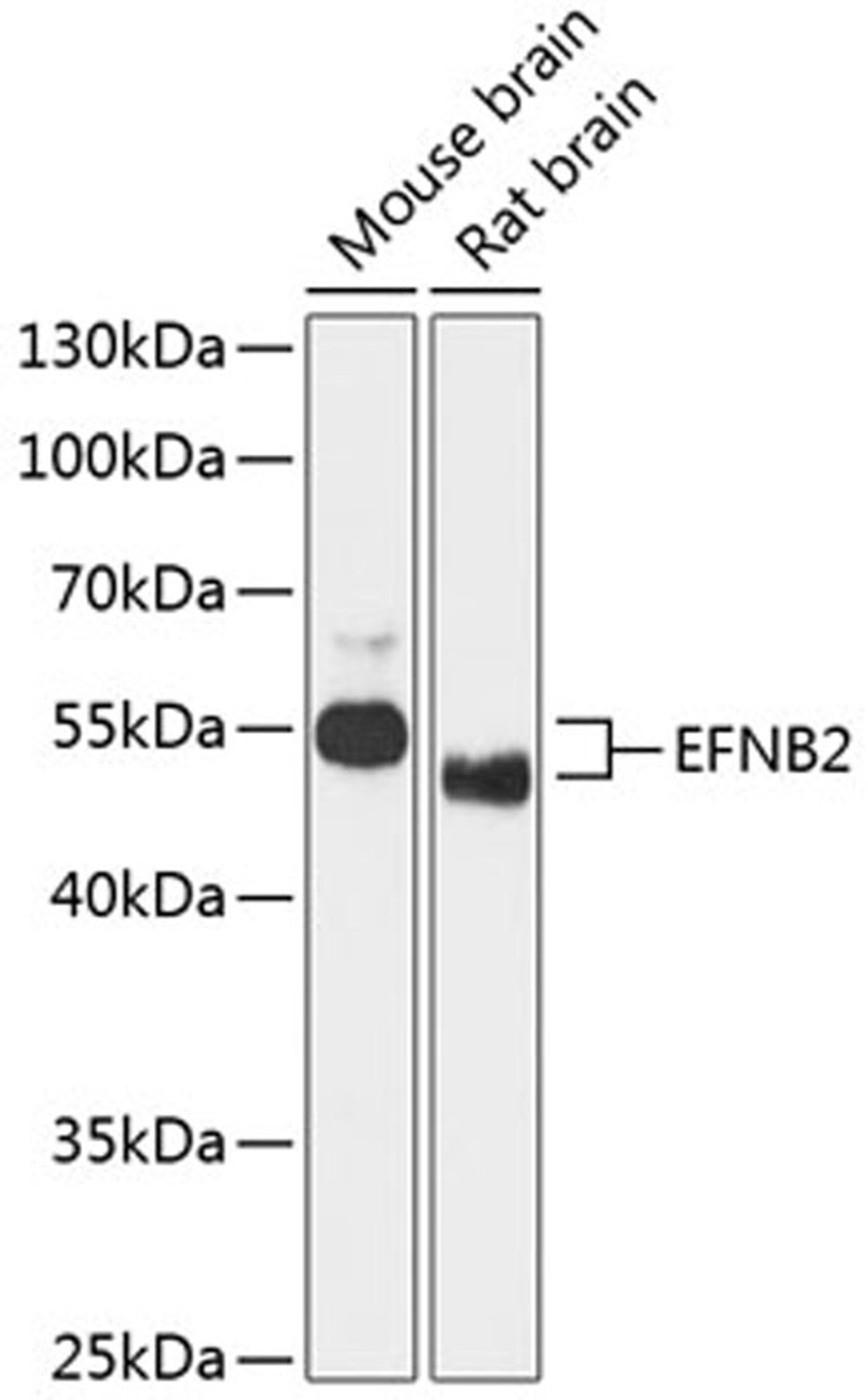 Western blot - EFNB2 antibody (A12961)