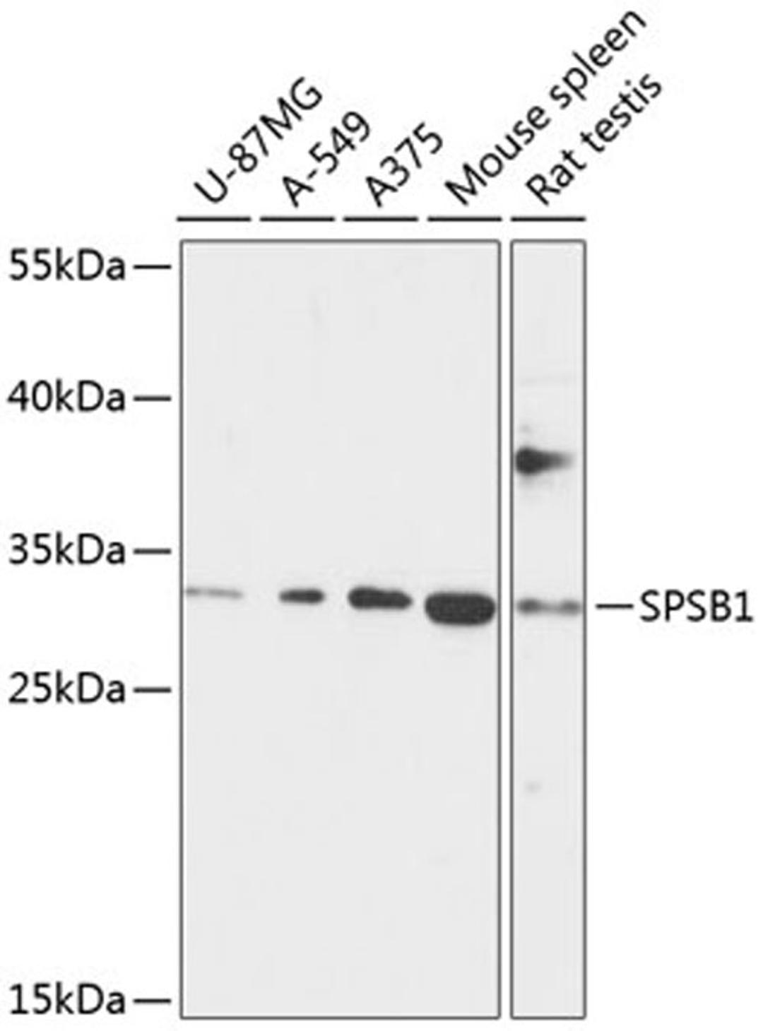 Western blot - SPSB1 antibody (A13886)