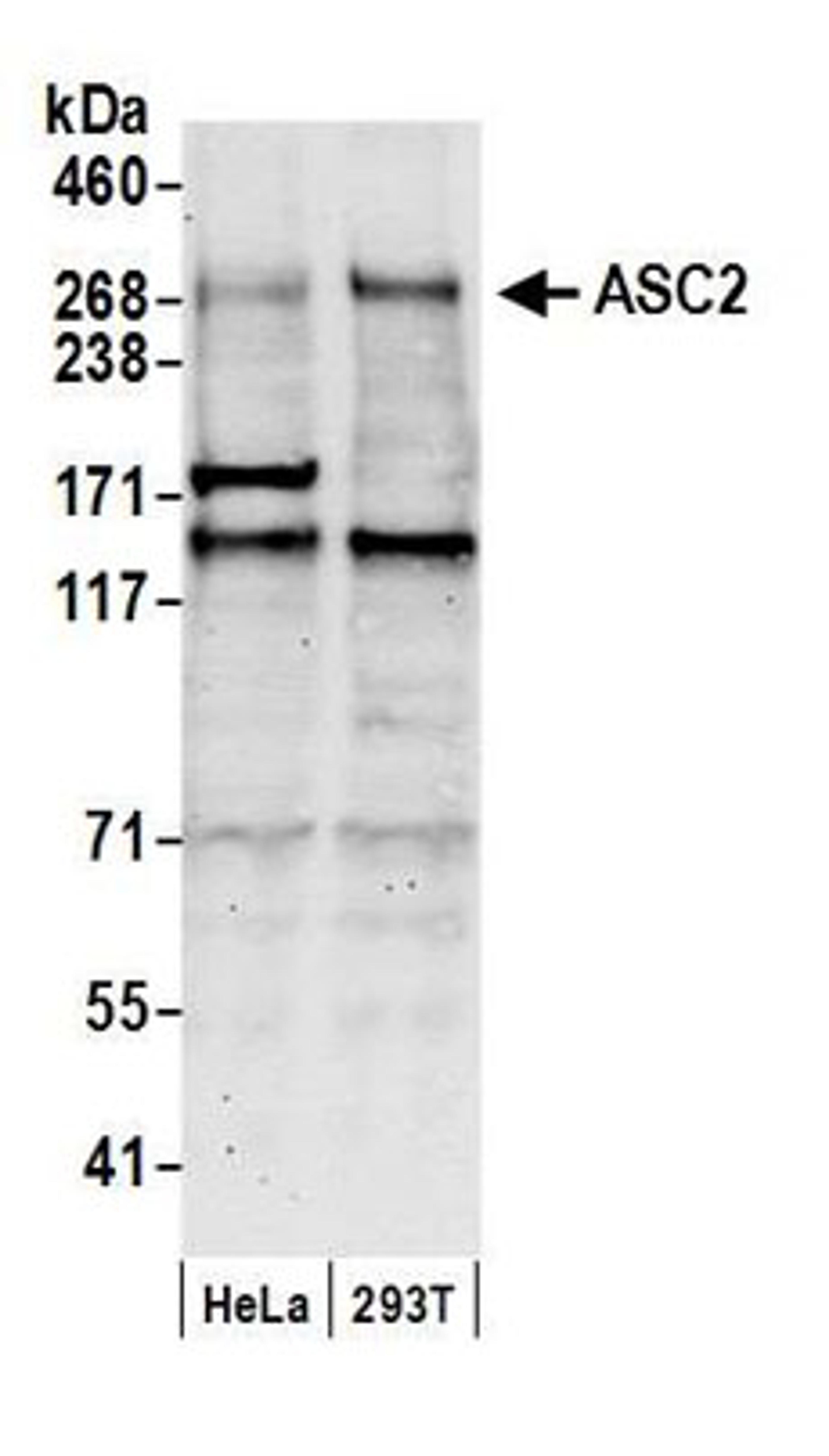 Detection of human ASC2 by western blot.