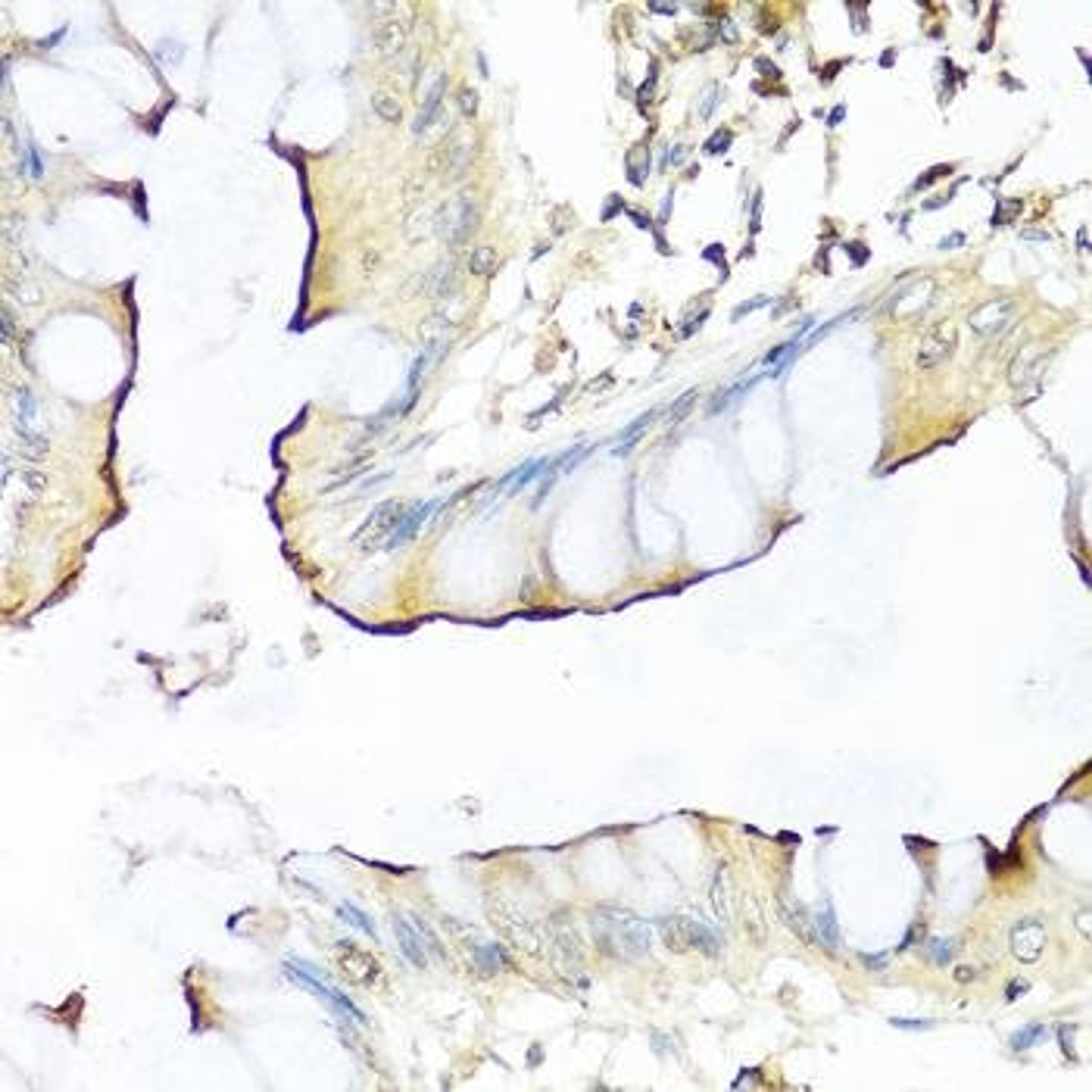 Immunohistochemical staining of rat brain tissue using NRG4 antibody (dilution of 1:100)