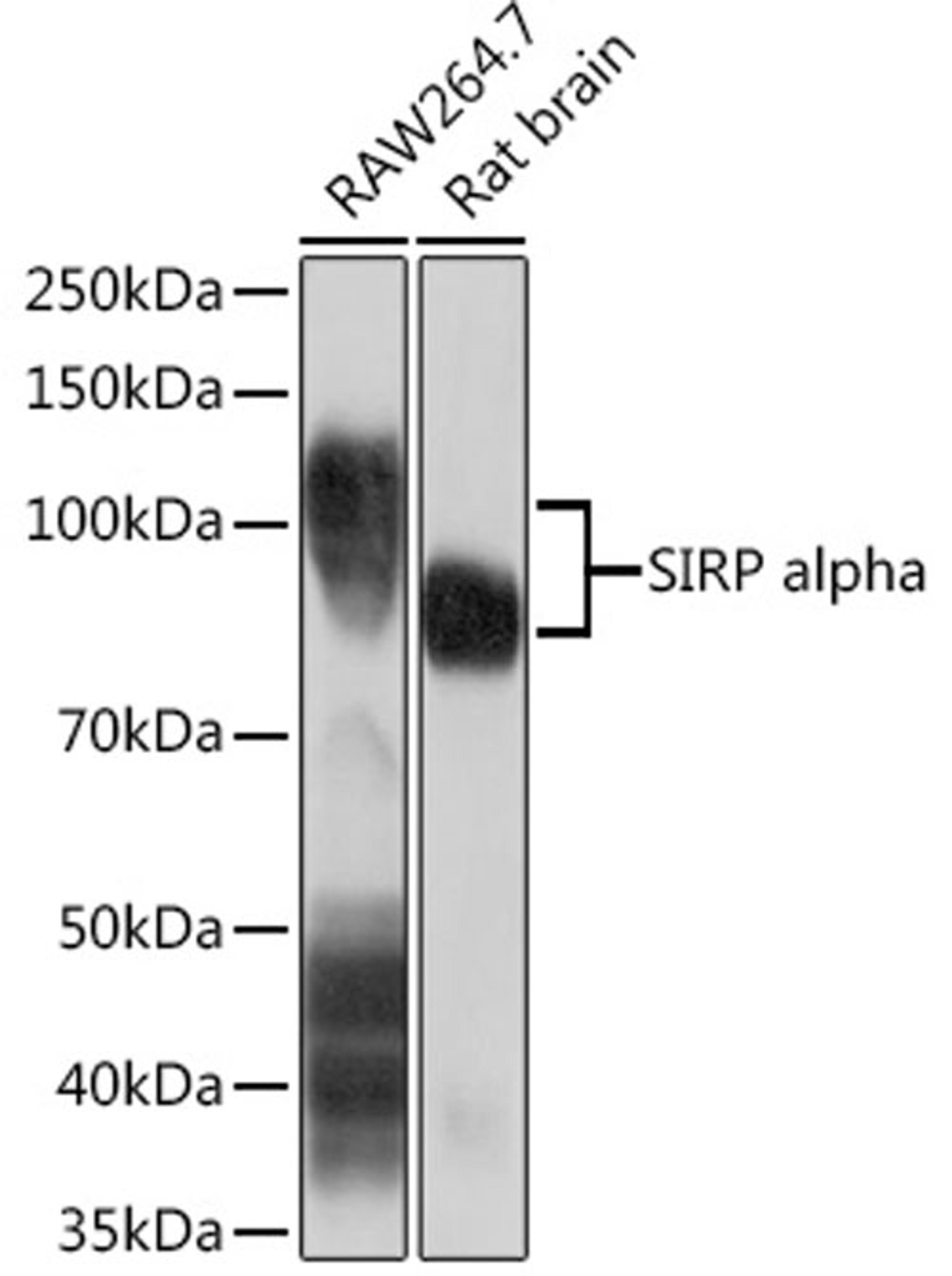 Western blot - SIRP alpha Rabbit mAb (A9545)