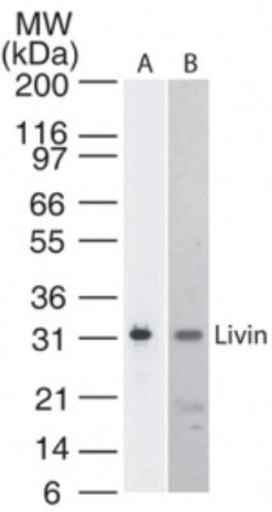 Western Blot: Livin Antibody (88C570) [NB100-56548] - detection of Livin in A) Livin transfected cell lysate and B) Molt4 cell lysate. A protein band of apprximate molecular weight of 31 kDa is detected using this antibody.