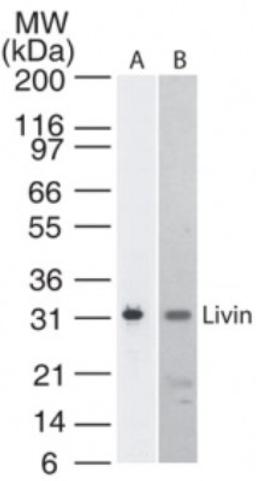 Western Blot: Livin Antibody (88C570) [NB100-56548] - detection of Livin in A) Livin transfected cell lysate and B) Molt4 cell lysate. A protein band of apprximate molecular weight of 31 kDa is detected using this antibody.