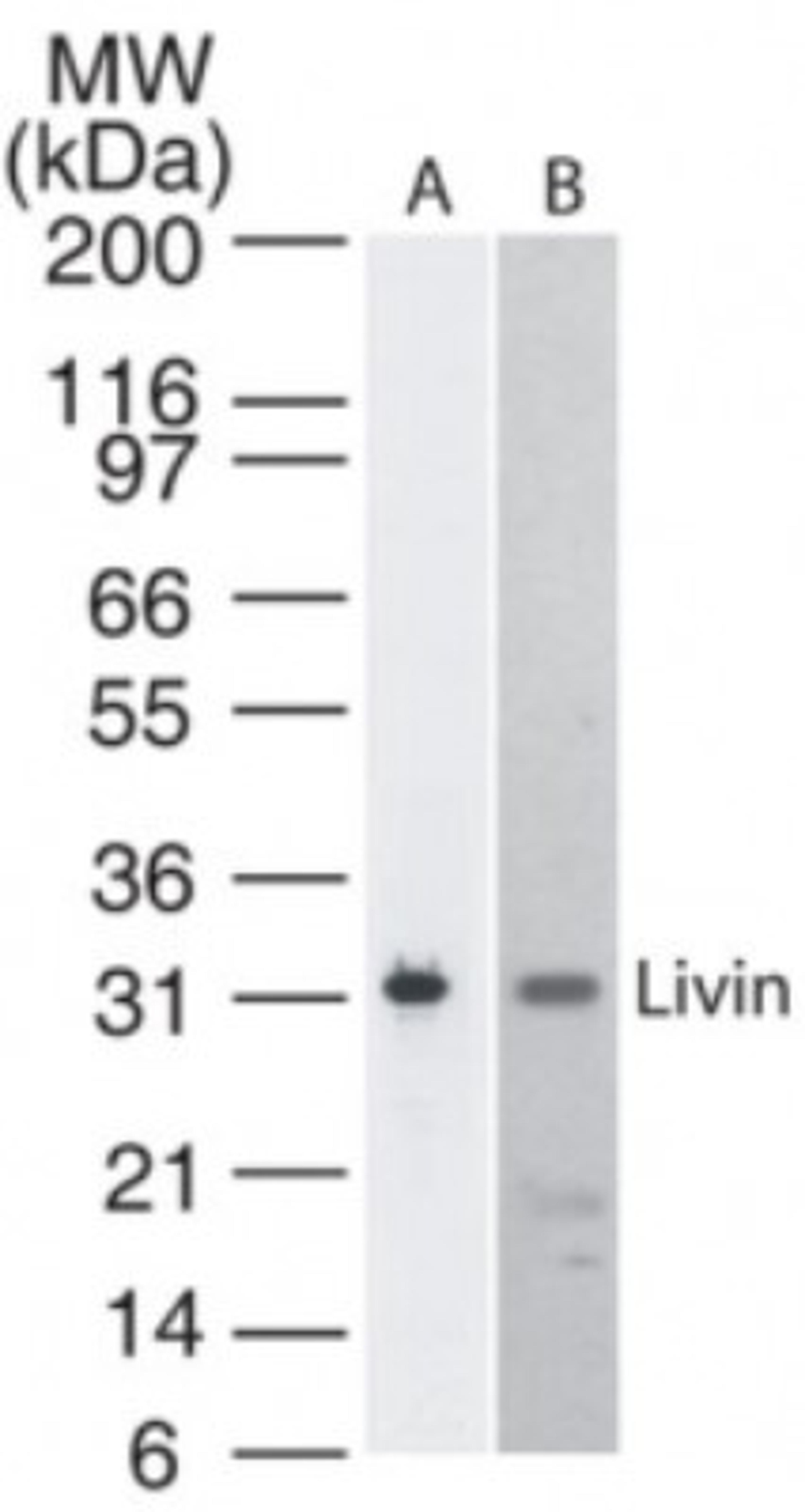 Western Blot: Livin Antibody (88C570) [NB100-56548] - detection of Livin in A) Livin transfected cell lysate and B) Molt4 cell lysate. A protein band of apprximate molecular weight of 31 kDa is detected using this antibody.