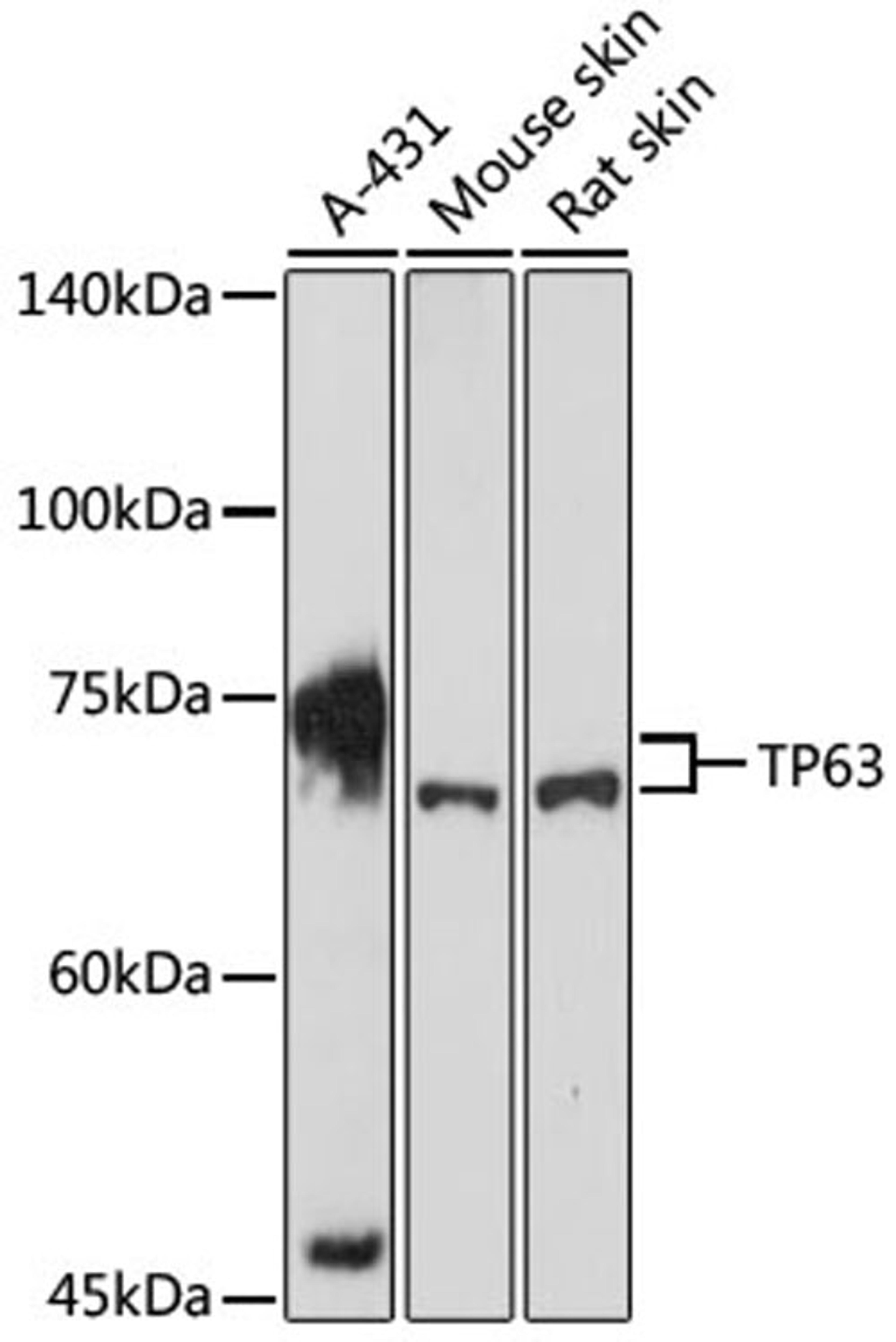 Western blot - TP63 antibody (A2137)