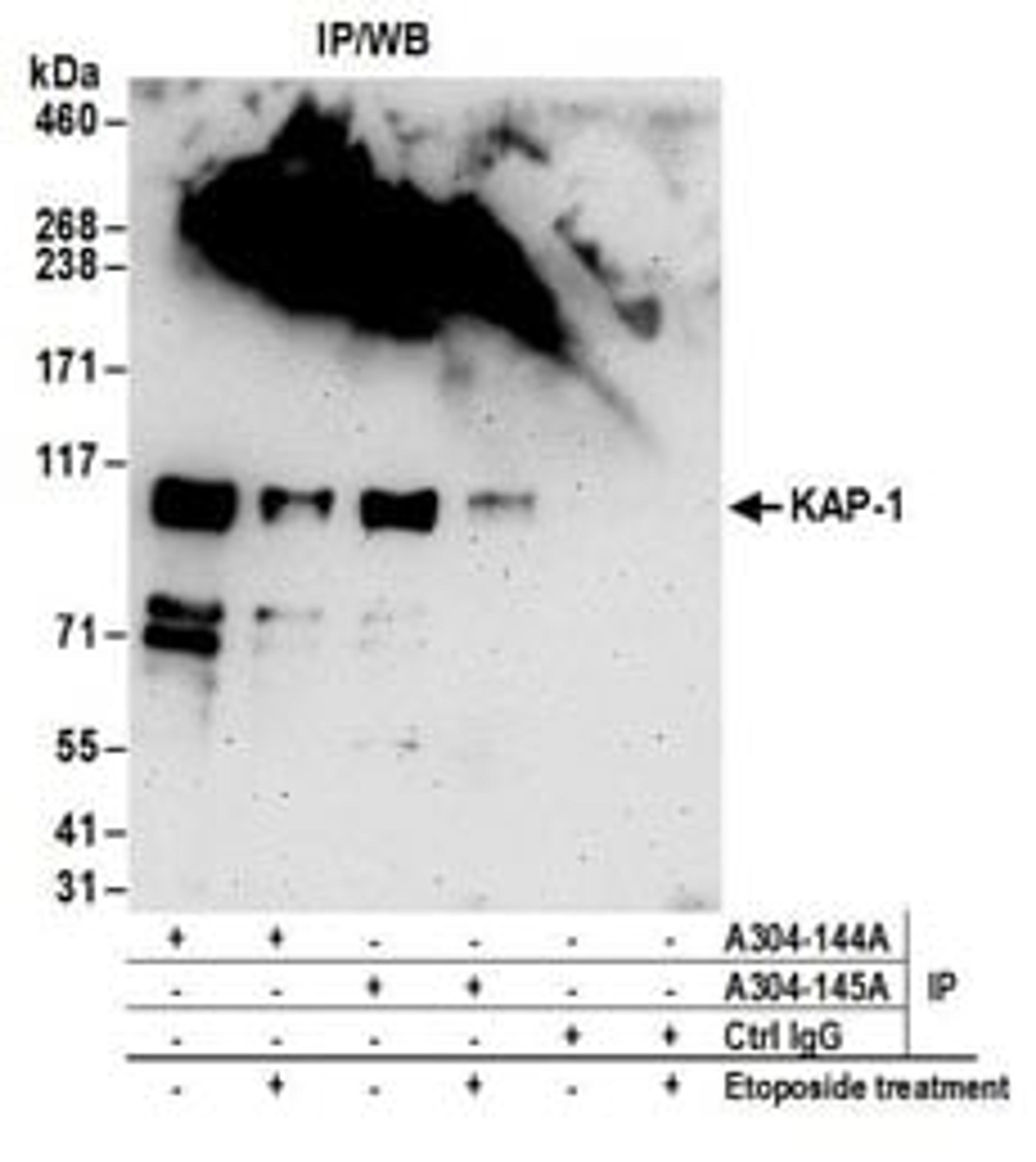 Detection of mouse KAP-1 by western blot of immunoprecipitates.