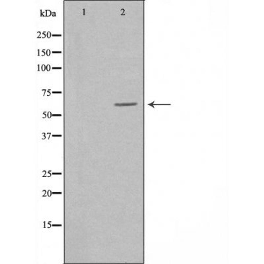 Western blot analysis of A549 cells using PVRL3 antibody