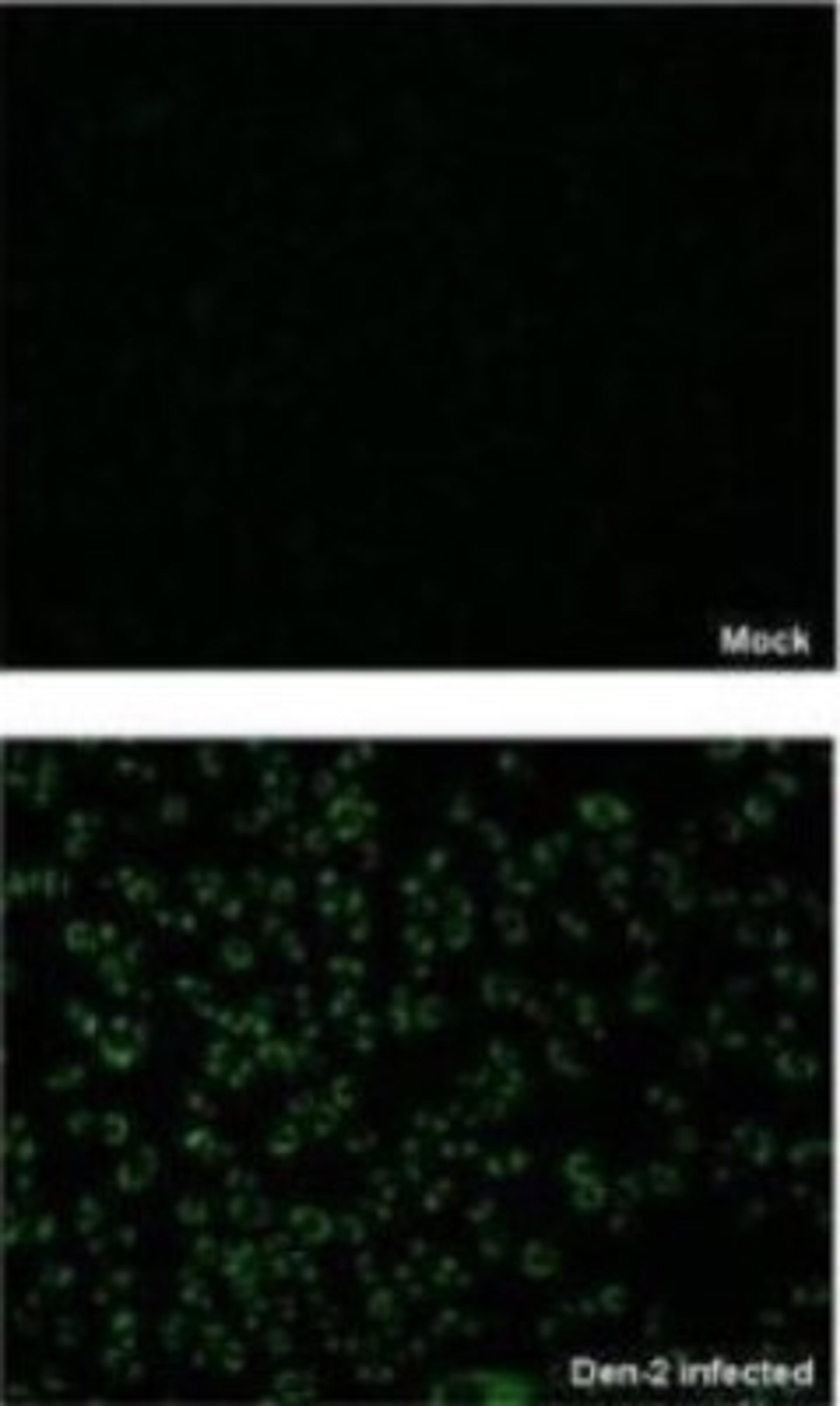 Immunocytochemistry/Immunofluorescence: SHP-2/PTPN11 Antibody [NBP2-42890] - Analysis of paraformaldehyde-fixed BHK-21 cell, using NS1 (Dengue virus 2) antibody at 1:2000 dilution.