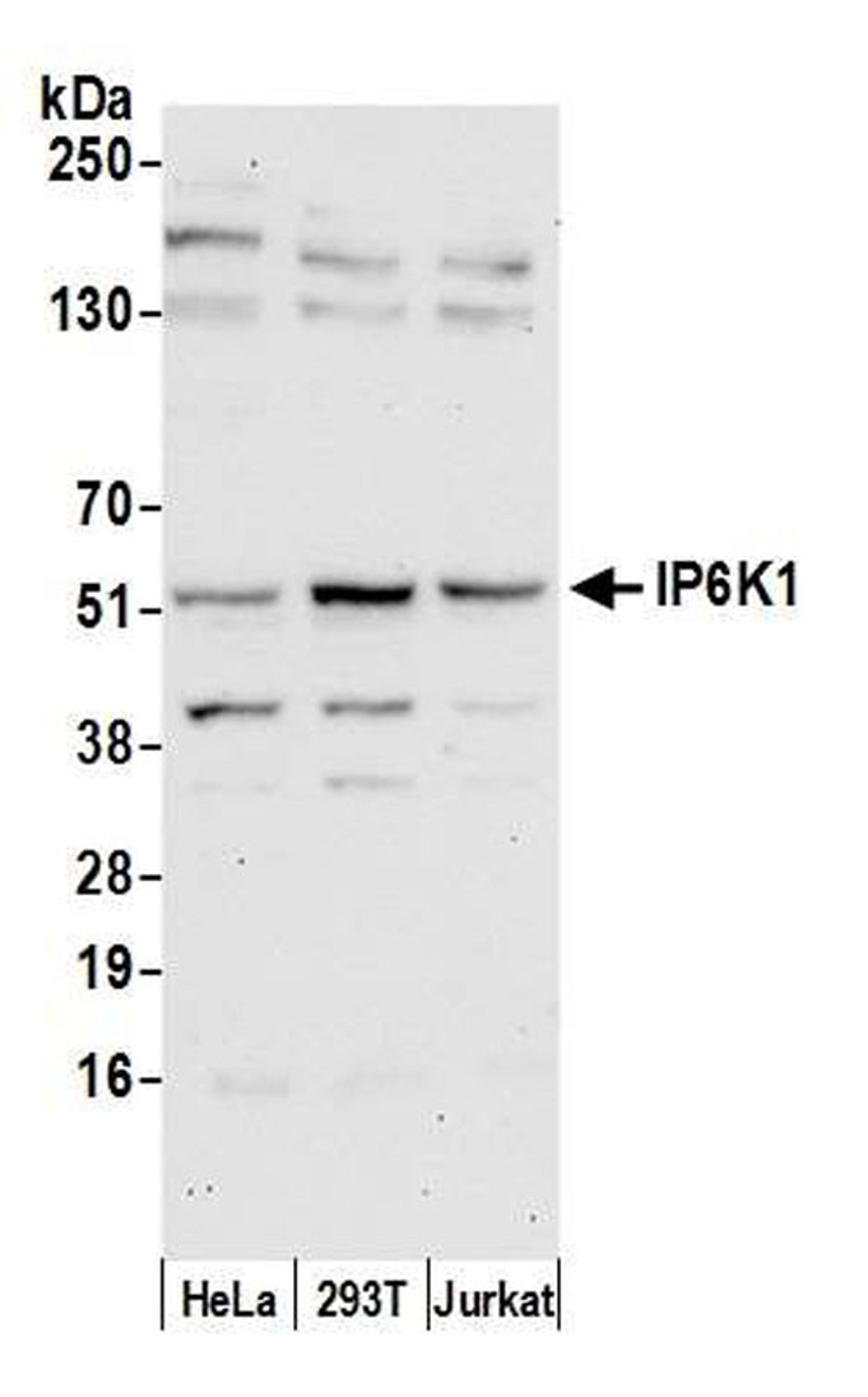 Detection of human IP6K1 by WB.