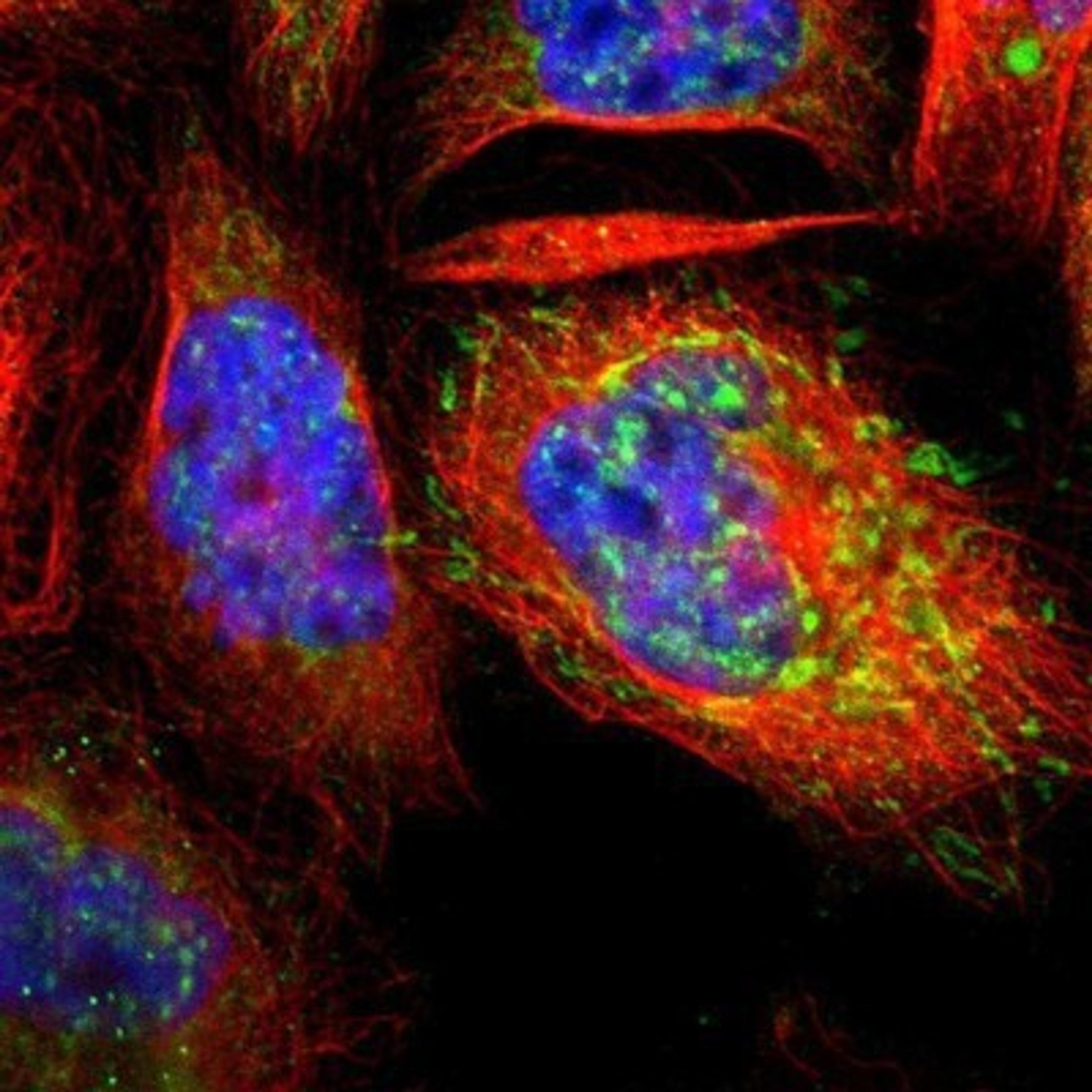 Immunocytochemistry/Immunofluorescence: PITRM1 Antibody [NBP1-81728] - Staining of human cell line A-431 shows positivity in nucleus & mitochondria.