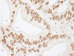 Detection of human CREB by immunohistochemistry.