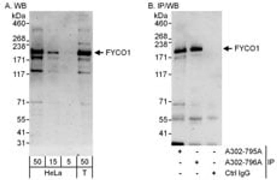 Detection of human FYCO1 by western blot and immunoprecipitation.