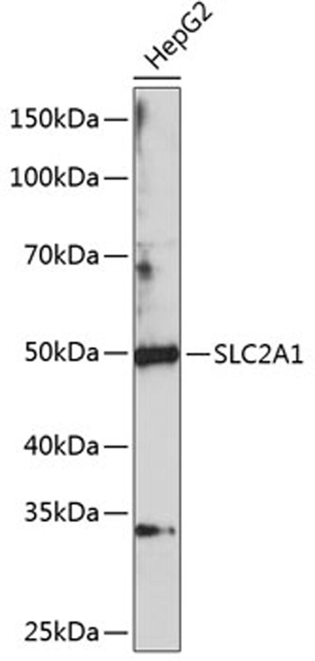 Western blot - GLUT1 Polyclonal Antibody (A11208)