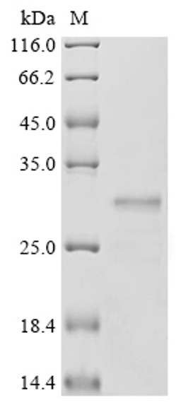 (Tris-Glycine gel) Discontinuous SDS-PAGE (reduced) with 5% enrichment gel and 15% separation gel.