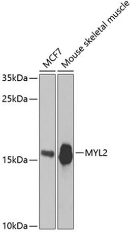 Western blot - MYL2 antibody (A5473)