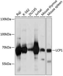 Western blot - LCP1 antibody (A5561)