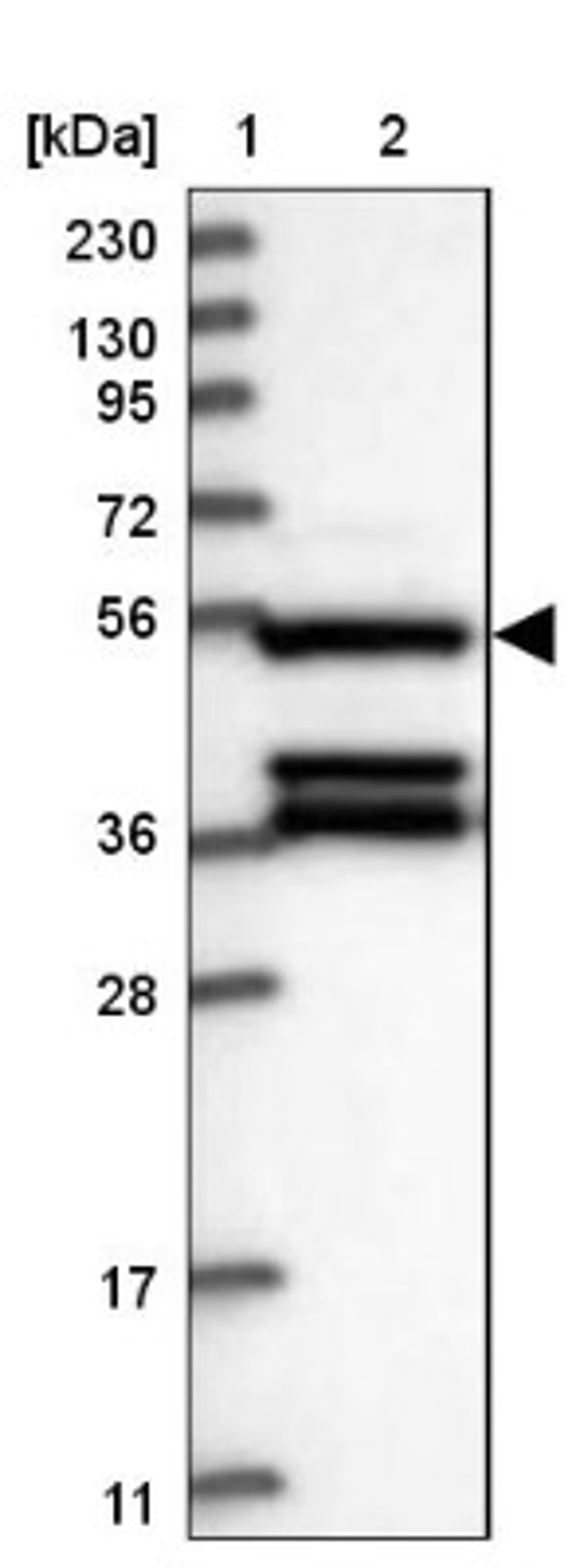 Western Blot: DELGEF Antibody [NBP1-88025] - Lane 1: Marker [kDa] 230, 130, 95, 72, 56, 36, 28, 17, 11<br/>Lane 2: Human cell line RT-4