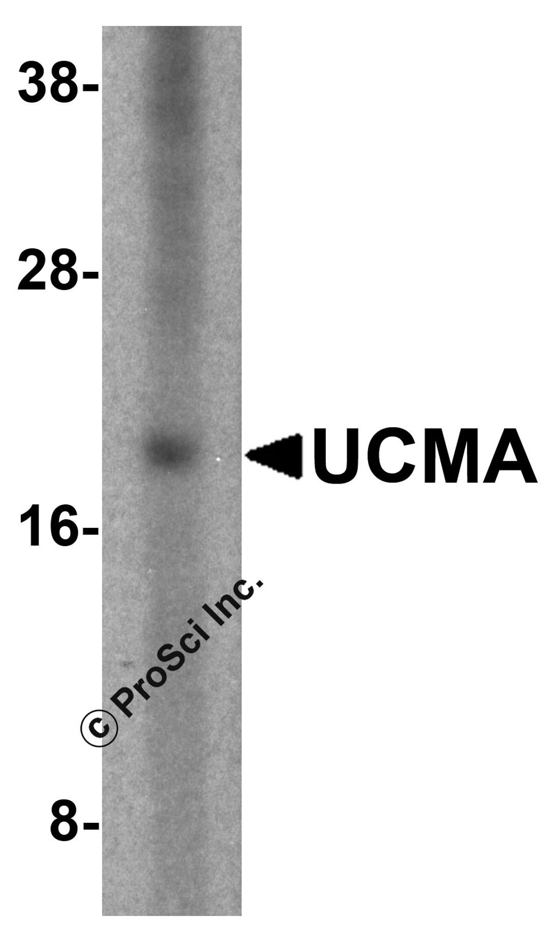 Western blot analysis of UCMA in SW1353 cell lysate with UCMA antibody at 2.5 μg/mL.