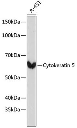 Western blot - Cytokeratin 5 Rabbit mAb (A11396)