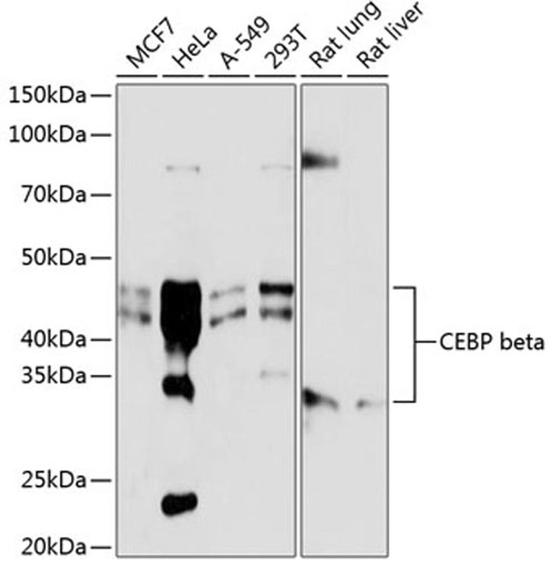 Western blot - CEBP beta antibody (A19538)