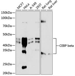 Western blot - CEBP beta antibody (A19538)