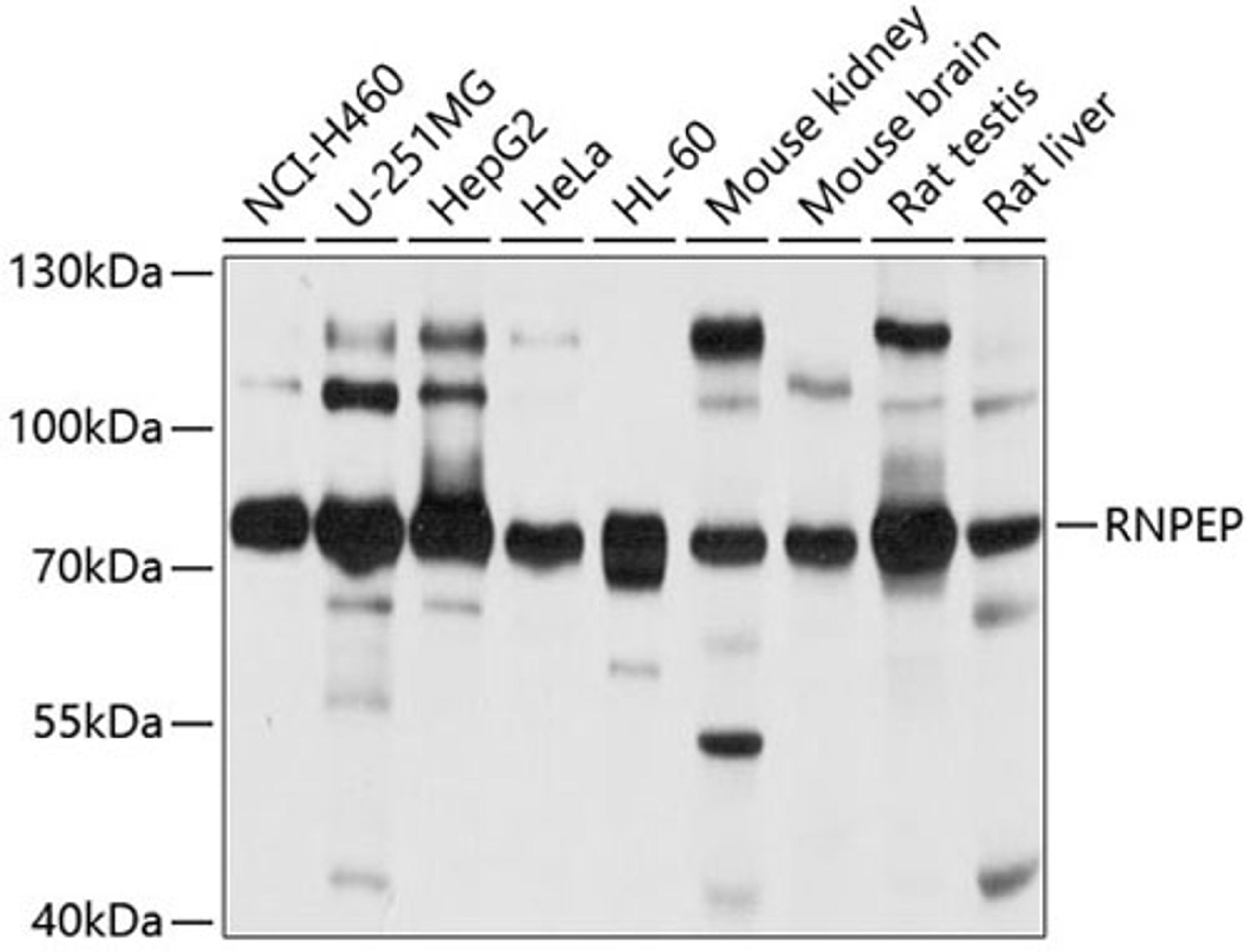 Western blot - RNPEP antibody (A4080)