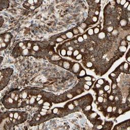 Immunohistochemistry-Paraffin: DHRS3 Antibody [NBP1-80846] - Staining of human colon shows strong cytoplasmic positivity in glandular cells.