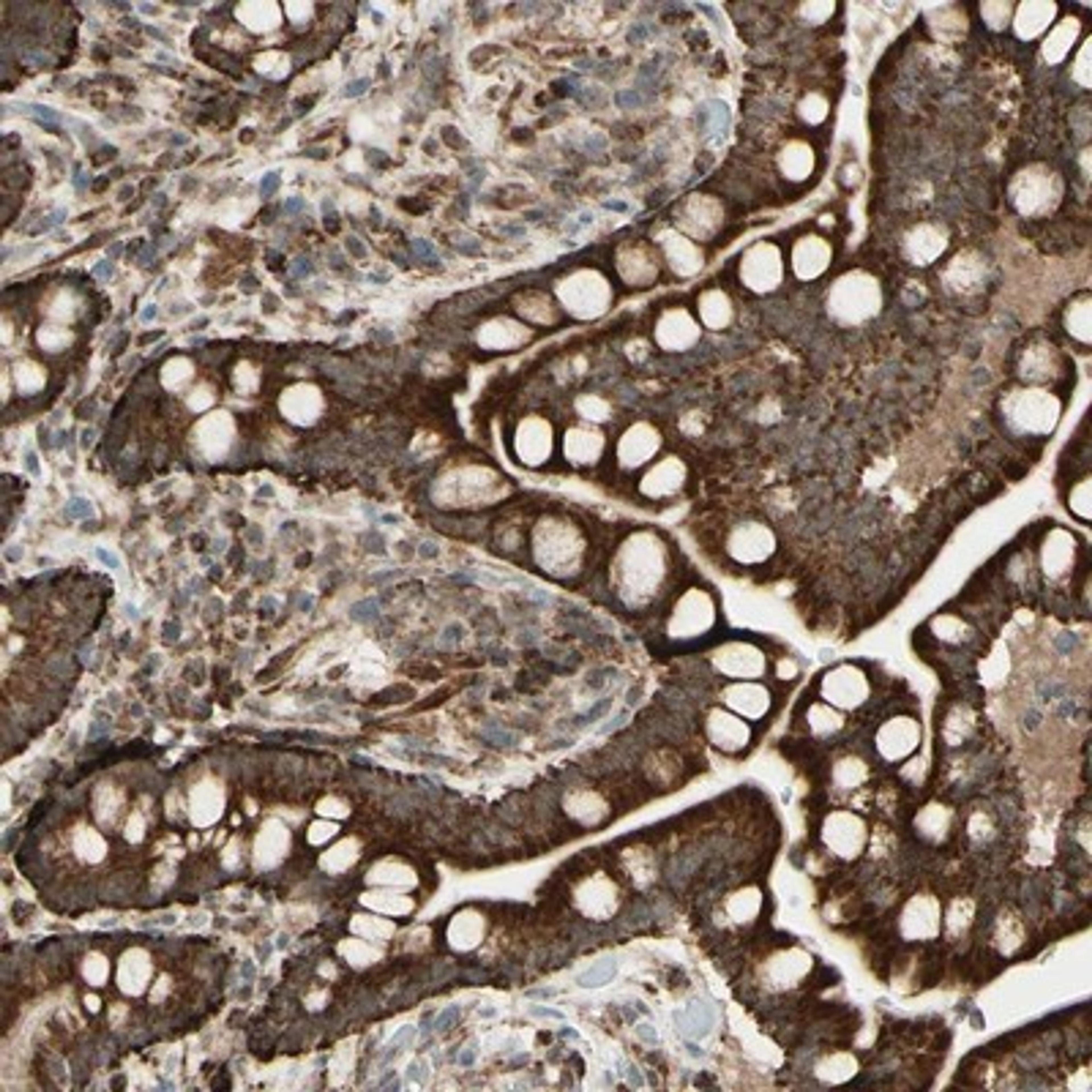 Immunohistochemistry-Paraffin: DHRS3 Antibody [NBP1-80846] - Staining of human colon shows strong cytoplasmic positivity in glandular cells.