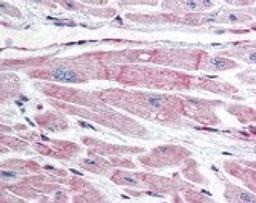 Immunohistochemistry staining of BIRC7 in heart tissue using BIRC7 monoclonal Antibody.