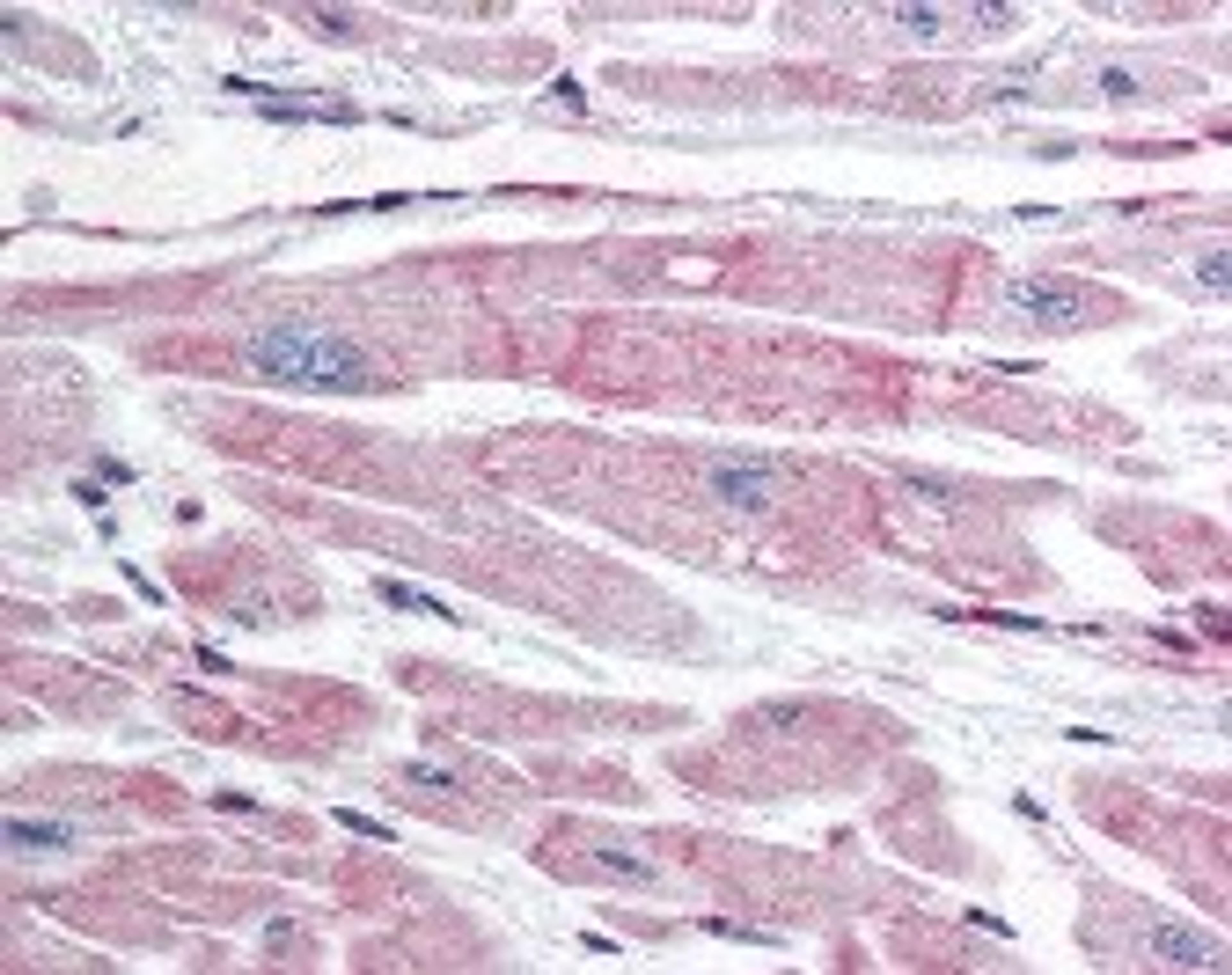 Immunohistochemistry staining of BIRC7 in heart tissue using BIRC7 monoclonal Antibody.