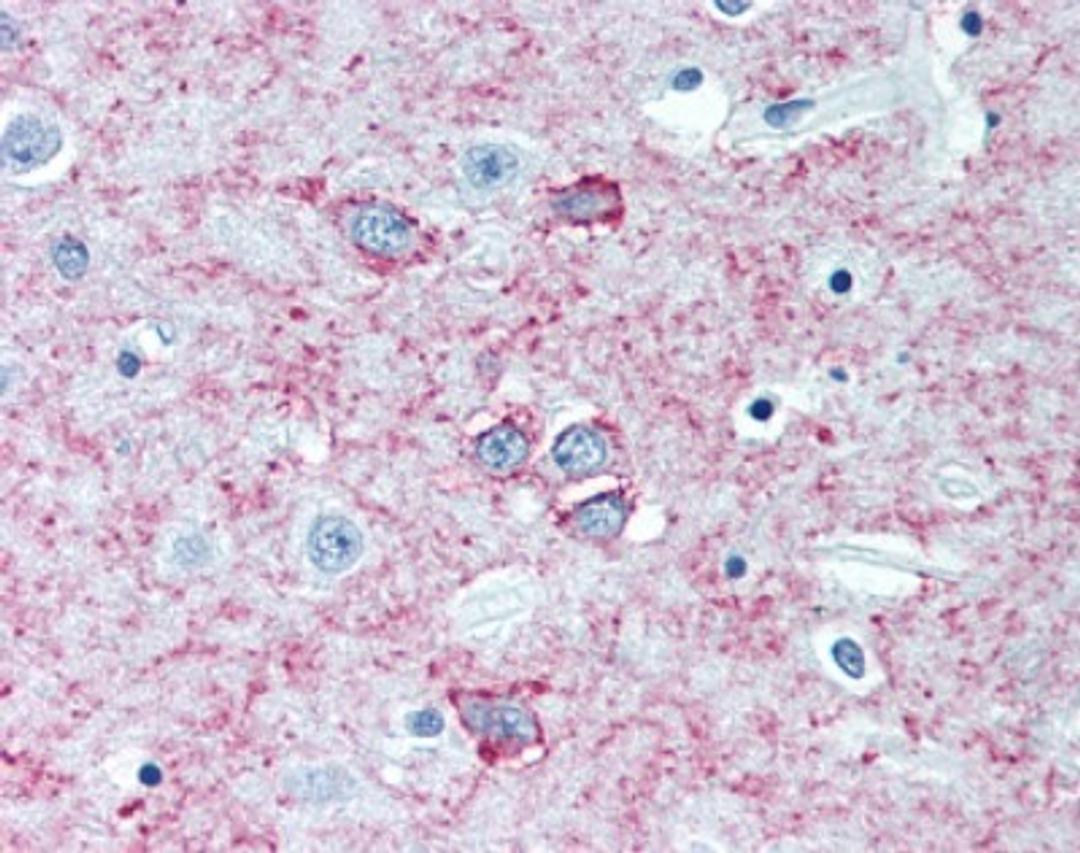 Immunohistochemistry-Paraffin: Adenosine A2a R Antibody (7F6-G5-A2) [NBP1-39474] - Analysis of anti-ADORA2A antibody with human brain, putamen at concentration 5 ug/ml.