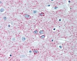 Immunohistochemistry-Paraffin: Adenosine A2a R Antibody (7F6-G5-A2) [NBP1-39474] - Analysis of anti-ADORA2A antibody with human brain, putamen at concentration 5 ug/ml.