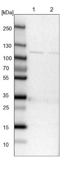 Western Blot: IARS2 Antibody [NBP1-84637] - Lane 1: NIH-3T3 cell lysate (Mouse embryonic fibroblast cells)<br/>Lane 2: NBT-II cell lysate (Rat Wistar bladder tumour cells)