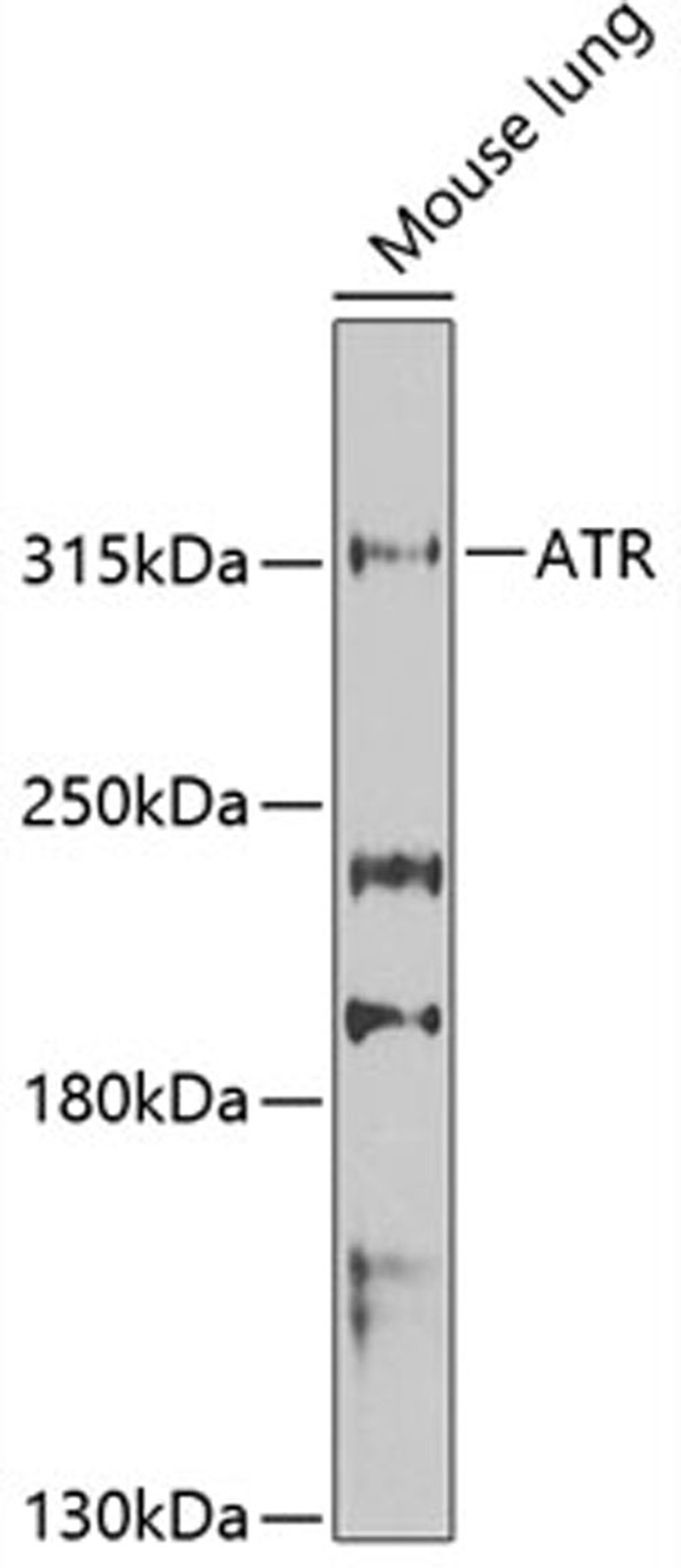 Western blot - ATR Antibody (A13951)