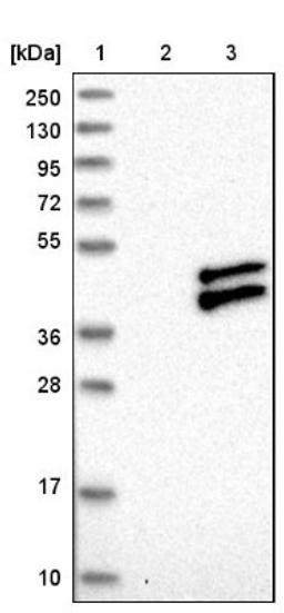 Western Blot: RWDD2B Antibody [NBP1-88272] - Lane 1: Marker [kDa] 250, 130, 95, 72, 55, 36, 28, 17, 10<br/>Lane 2: Negative control (vector only transfected HEK293T lysate)<br/>Lane 3: Over-expression lysate (Co-expressed with a C-terminal myc-DDK tag (~3.1 kDa) in mammalian HEK293T cells, LY413791)