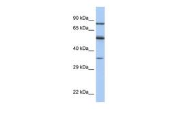 Antibody used in WB on Human Jurkat 0.2-1 ug/ml.