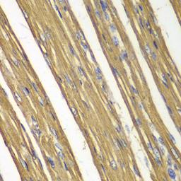 Immunohistochemistry  - Caspase-7 antibody (A0716)