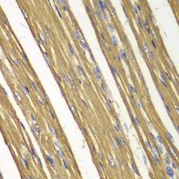 Immunohistochemistry - Caspase-7 antibody (A0716)