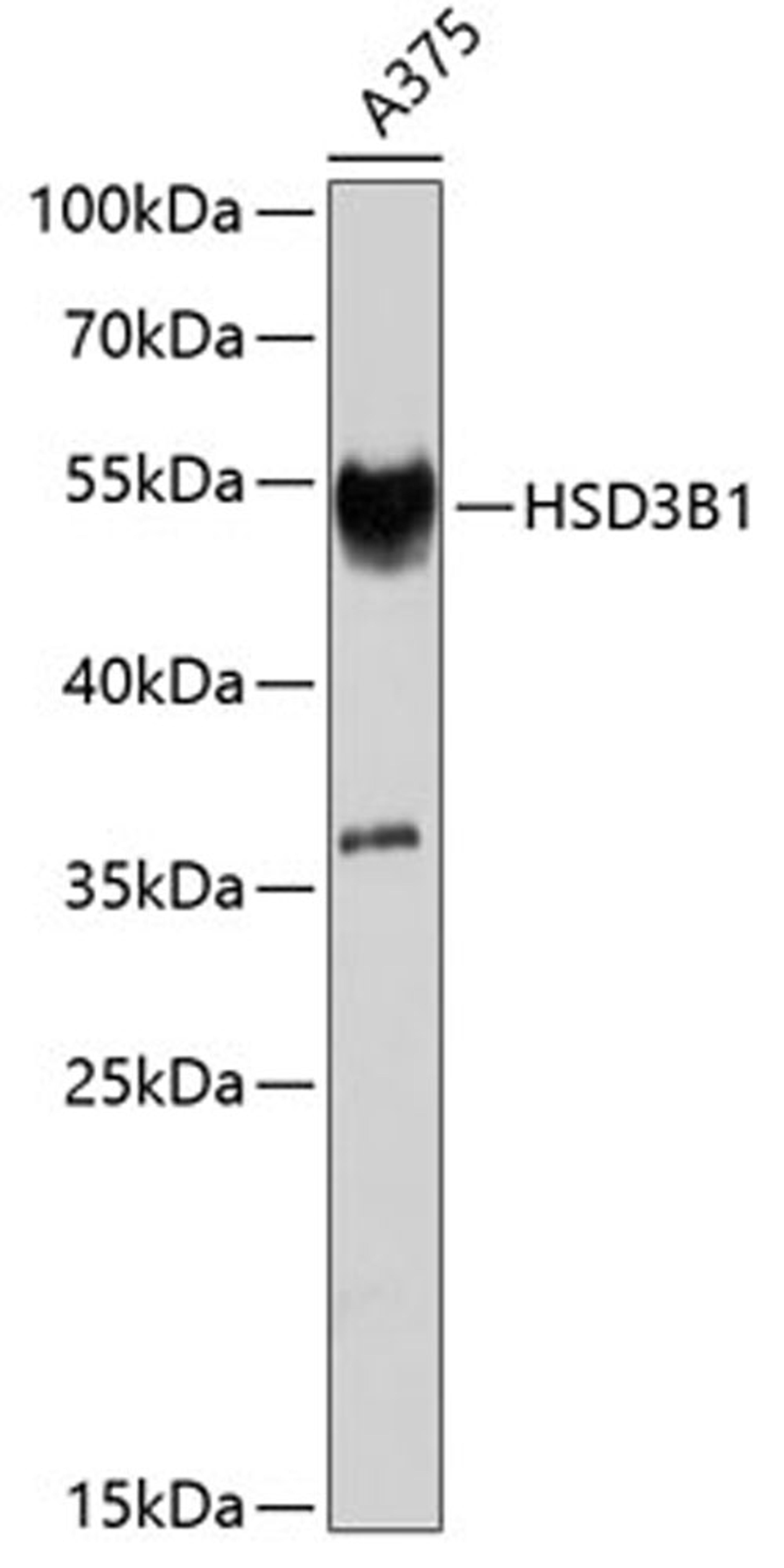 Western blot - HSD3B1 antibody (A8035)