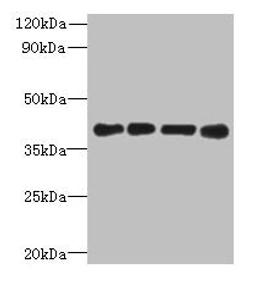 Western blot. All lanes: MAGEB18 antibody at 12µg/ml. Lane 1: MCF-7 whole cell lysate. Lane 2: A549 whole cell lysate. Lane 3: Hela whole cell lysate. Lane 4: Mouse heart tissue. Secondary. Goat polyclonal to rabbit IgG at 1/10000 dilution. Predicted band size: 39 kDa. Observed band size: 39 kDa