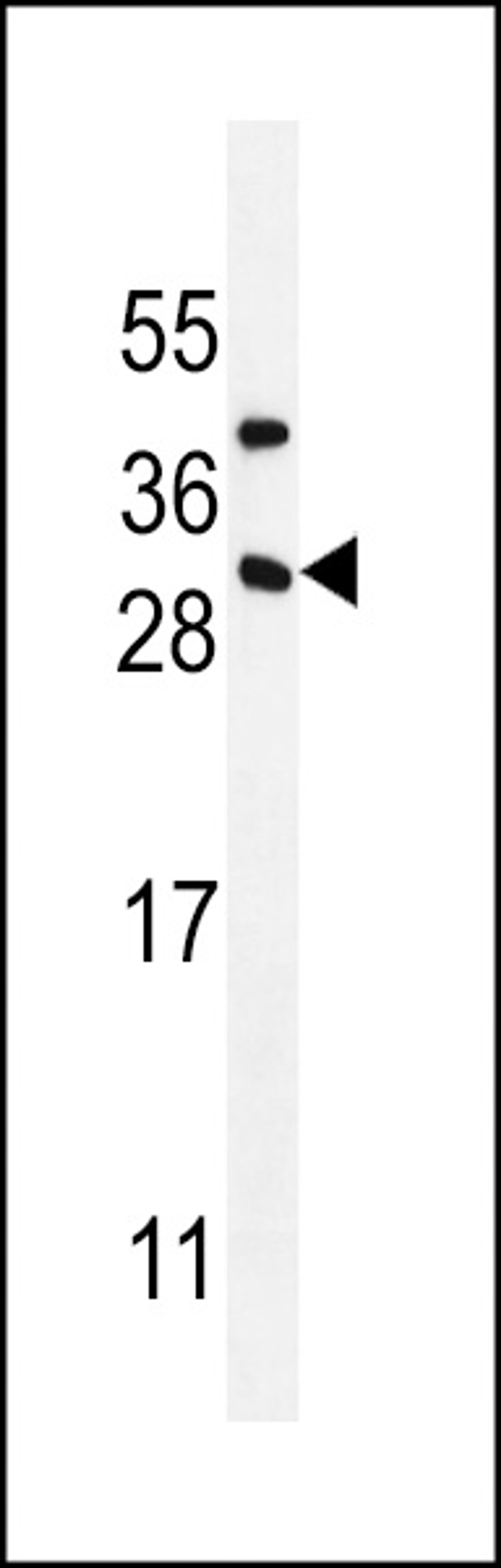 Western blot analysis in MDA-MB435 cell line lysates (35ug/lane).