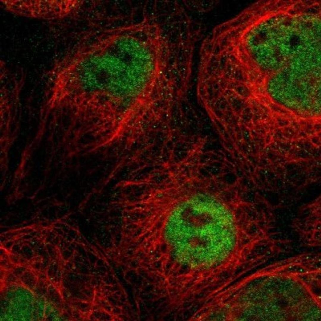 Immunocytochemistry/Immunofluorescence: SLC15A4 Antibody [NBP1-87279] - Staining of human cell line A-431 shows positivity in nucleus but not nucleoli.