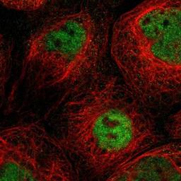 Immunocytochemistry/Immunofluorescence: SLC15A4 Antibody [NBP1-87279] - Staining of human cell line A-431 shows positivity in nucleus but not nucleoli.