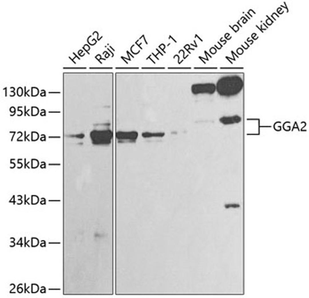 Western blot - GGA2 antibody (A1186)